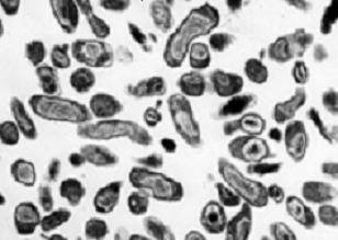 Sốt Q - Hình ảnh minh họa